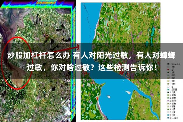 炒股加杠杆怎么办 有人对阳光过敏，有人对蟑螂过敏，你对啥过敏？这些检测告诉你！